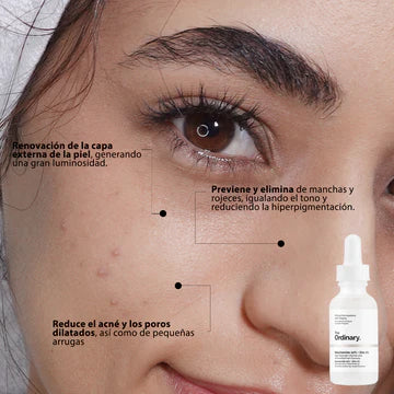 NIACINAMIDE AL 10% + 1%ZIN THE ORDINARY