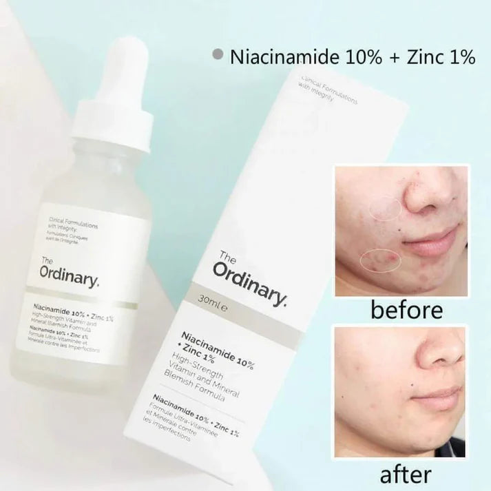 NIACINAMIDE AL 10% + 1%ZIN THE ORDINARY